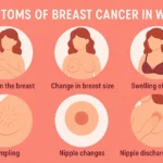 breast cancer for women