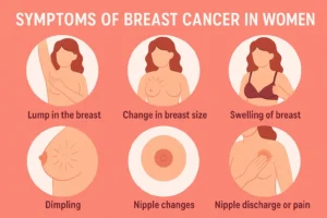 Symptoms of Breast Cancer in Women: What to Watch for in 2025
